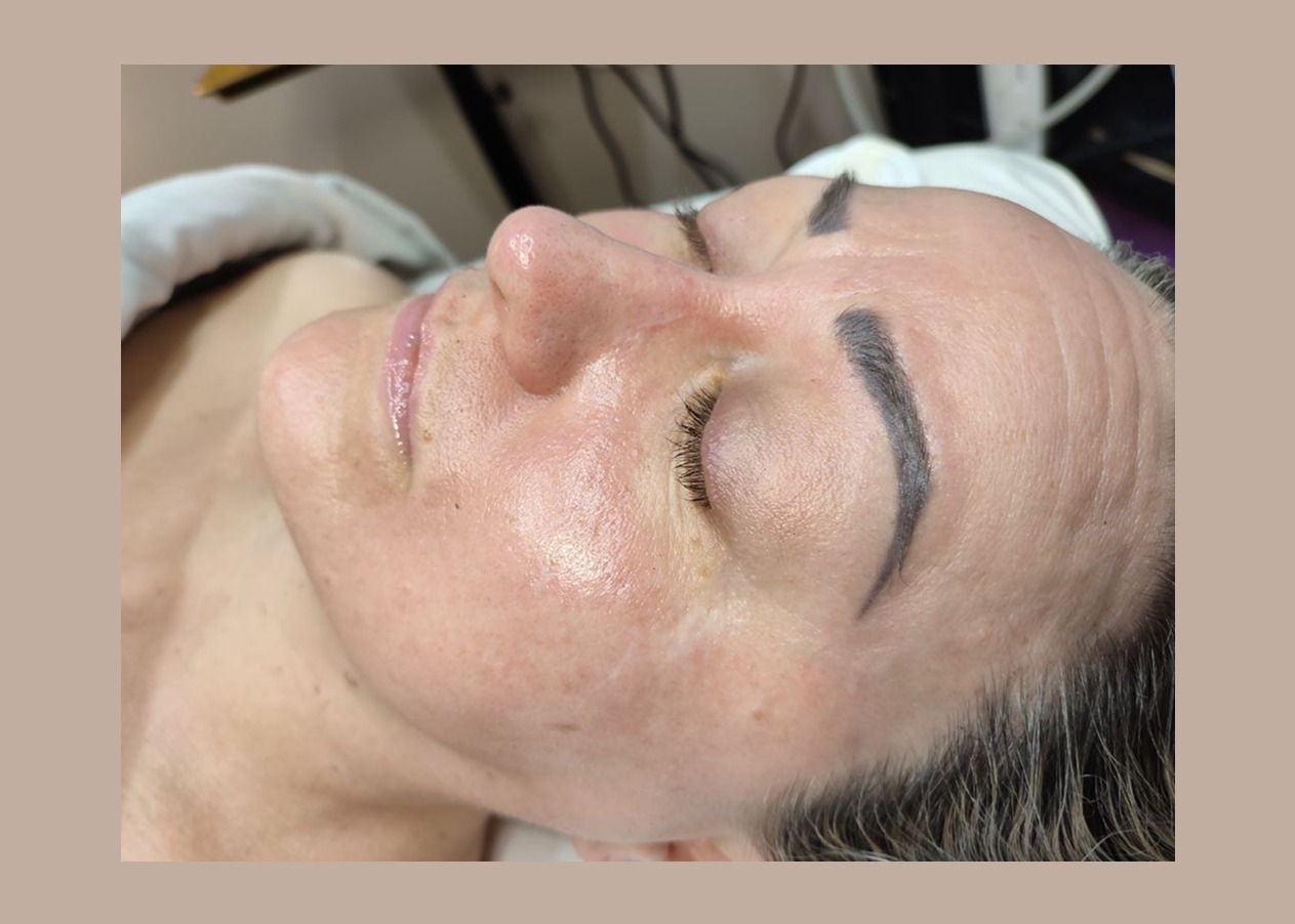 Anti-aging in Las Vegas
