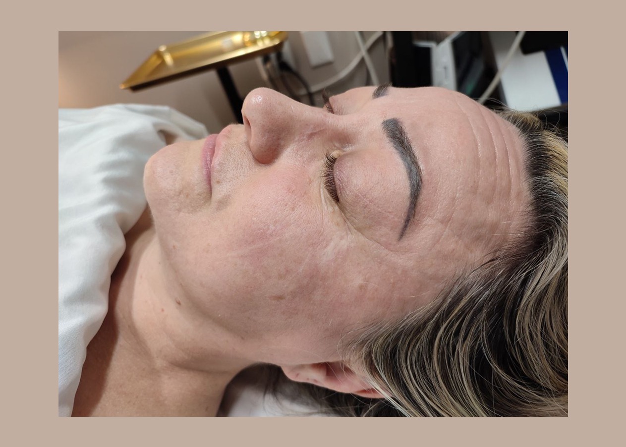 Anti-aging in Las Vegas