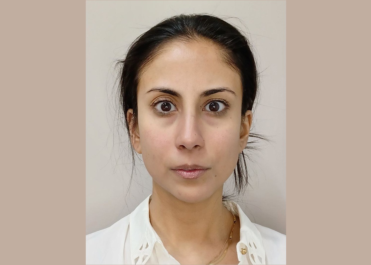Buccal massage after 333 Buccal massage in Las Vegas