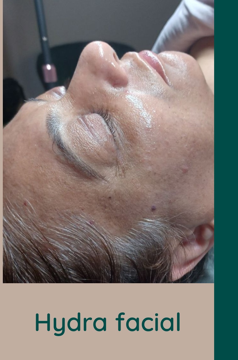 Hydra facial in las vegas