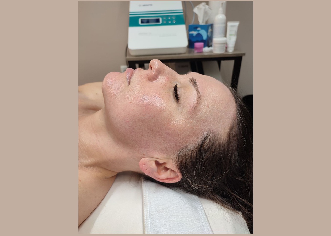 Hydra facial Las Vegas