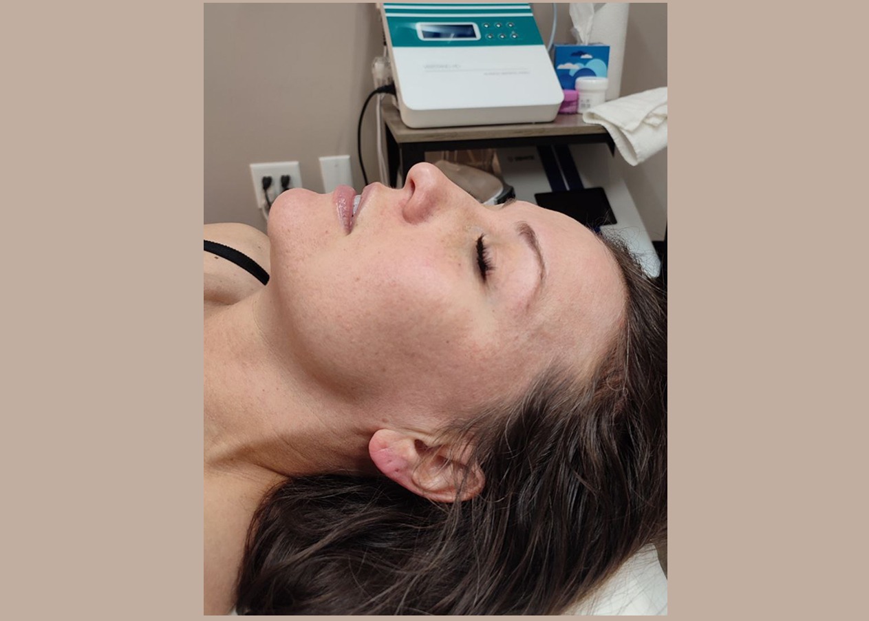 Hydra facial Las Vegas